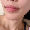 노을스튜디오 | 역삼입술 스튜디오 노을 망한입술 살리고온 내돈내산 대만족후기