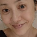 리즈케어 이미지