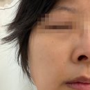 송파24약국 | 송파에스테틱 홍조관리 쁘에르 후기