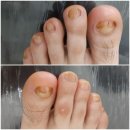 레푸스 앤 두두네일 이미지