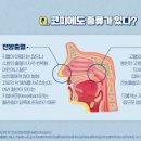 갑자기 코피 나는 이유 원인과 빠르게 멈추는법 이미지