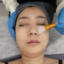 예쁜브이라인의원 | 은평구 웨딩관리 멜로즈뷰티 은평점 이중턱살빼기 후기