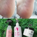 발뒤꿈치 각질 무좀 홈케어 내돈주고 산 3가지 제품으로 관리해본 후기(브랜드는 다 달라요)
