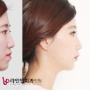 수림치과의원 네이버블로그