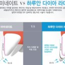 아이디치과기공소 네이버블로그