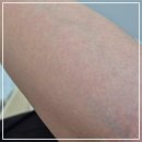 B09-2 | 내돈내산 청라 제모의 완벽한 해방구, B09 STUDIO 후기
