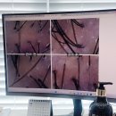 쿨스타 리페어 | 울산 송정동 두피디톡스 헤드스파k 여름철 두피관리 후기