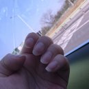 11545-03-16-11 | 자궁근종 선근증 수술후기 EP03.수술전준비