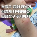 청구어린이집 | 수족구 증상부터 잠복기 보험청구 후기까지 한눈에 정리