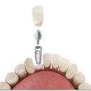 김해본치과의원 이미지