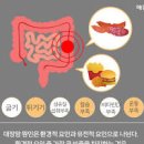 직장암 초기 원인 이미지