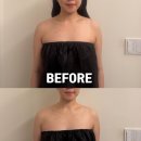 11620-21-96-5 | 12. 창원 웨딩관리 팔뚝 목어깨 라인 후기 라운드어바웃 내돈내산