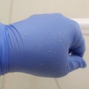 영인케어 | 마곡 에스테틱 영인피부 재방문 제대로 된 좁쌀 케어에 감동