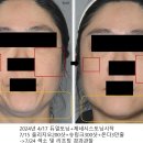 봄봄피부과의원 네이버블로그