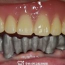 주안시카고치과의원 네이버블로그