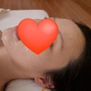 예쁜얼굴 | 위뷰티 예쁜얼굴 피부관리 후기 옆얼굴여백줄이기 효과 제대로