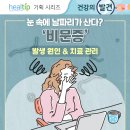 눈 속에 날파리가 산다? ‘비문증’ 발생 원인 & 치료‧관리 이미지