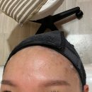 1433 | 포항 피부관리추천 더나은스킨 재방문후기