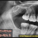 서울프리벤치과의원 이미지