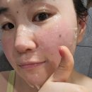 에프이티 FET 에스테틱화장품브랜드 홍조마스크팩 진정마스크 프로스티마스크팩 물먹피부 물광피부 에프...