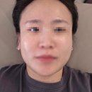 더바른몸 | 일산피부샵 더바른뷰티 몸의 순환을 도와주는 두피순환파동관리 후기