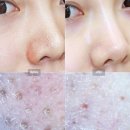 모공청소기팩으로 피지 흡착하고 깔끔 모공 완성 :)