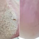 발건강관리사(2급) 이미지