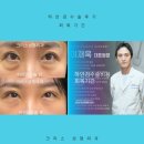 크리스성형외과의원 | 하안검수술비용 성형외과 선택이 중요