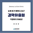 눈에 피가 맺혔다고요? &#39;결막하출혈&#39; 걱정하지 마세요😉 이미지