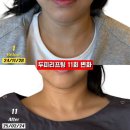 햇츠오프 | 압구정헤드스파? 1회만에 뚜렷한 비포/애프터가 가능한 이유 3가지