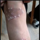 바로스탑한의원 이미지