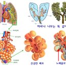 호흡 곤란, 숨이 차는 질병의 원인과 치료 이미지