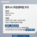 자궁 경부암3기 환자의 치료 사례 이미지