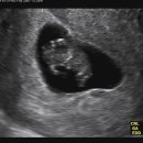 나비산부인과의원 이미지