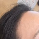 삼공헤어 | 당일예약, 점심시간 퀵시술 가능한 여성전용 왁싱샵 논현역 왁싱삼공 헤어라인왁싱 후기