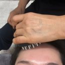 CU서산의료원사거리점 | 서산 에스테틱 추천, 서산 고운피부에서 받은 모공디톡스 솔직후기