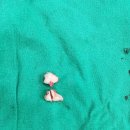 양재영치과의원 | [1탄] 사랑니 4개 뽑은 후기 / 수원 망포역 사랑니 전문 치과 / 사랑니 톡앤턱 치과의원