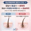 곱슬머리방