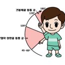 Painful arc(동통 궁) vs Pseudopainful arc 이미지