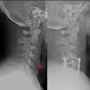 정형외과 시술의 역사 이미지