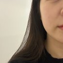 신곡지구대 | 의정부피부관리 ’성형안해도 청초 신곡점‘ 얼굴성형케어 후기