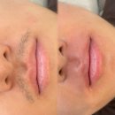 본수원 인계점 | 인계동 남자 수염왁싱 찾는 사람을 위한 예쁨왁싱 수원인계점 방문후기