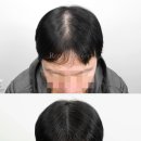 리게인프로젝트 부산점 이미지