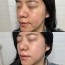 미스트 및 바르고 자면 되는 나이트팩 추천 그라운드플랜 후기
