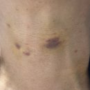 아카이브청담의원 이미지