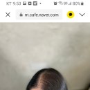 커버스토리뷰티스칼프 이미지