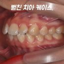 대치동교정치과 건강과 아름다움을 동시에