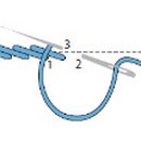 손과바늘 이미지