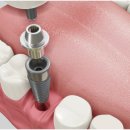 하양탑치과 이미지