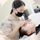 어나더81 이미지